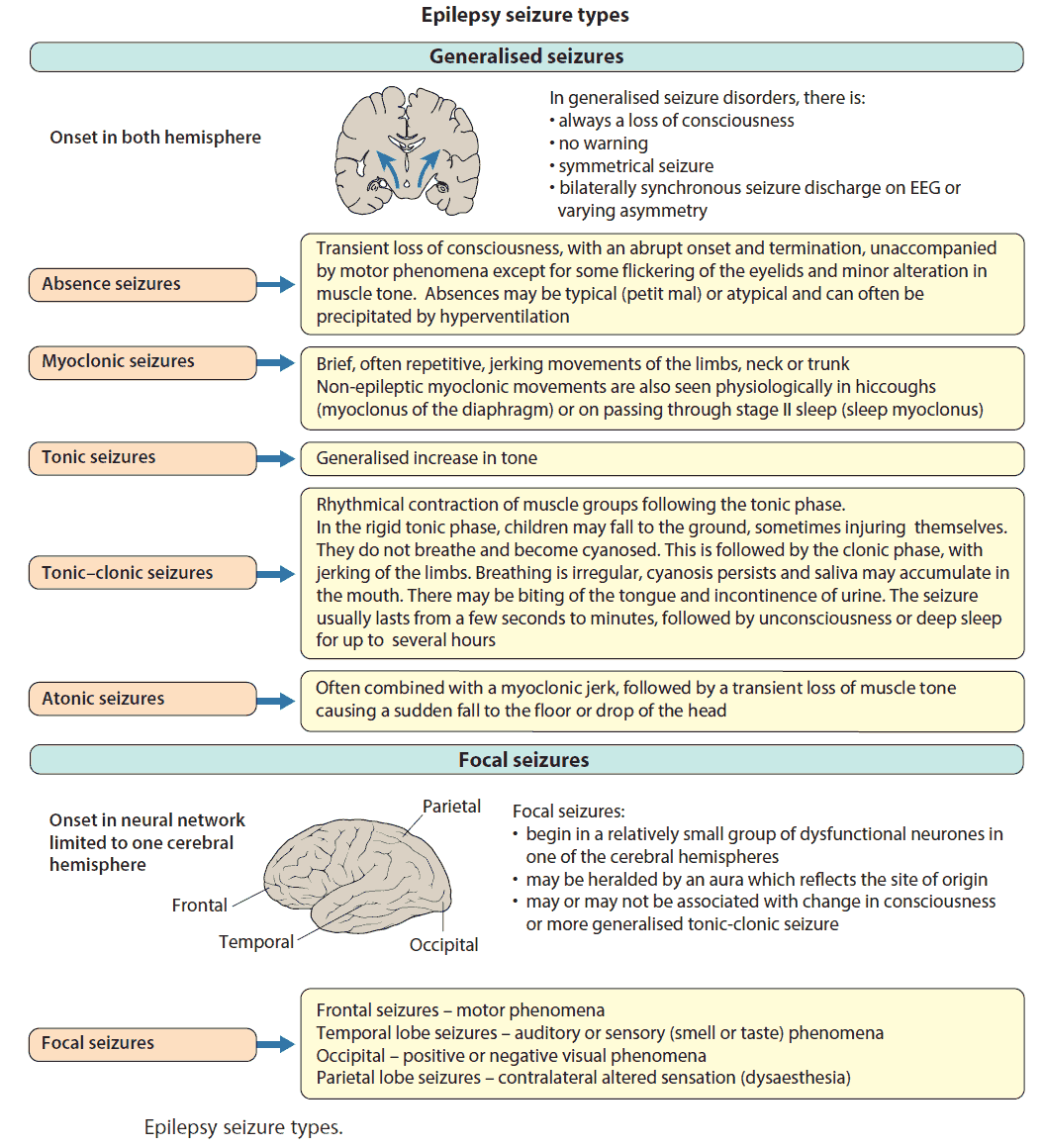 absence seizures in adults