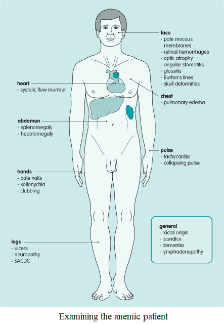 anemia patient