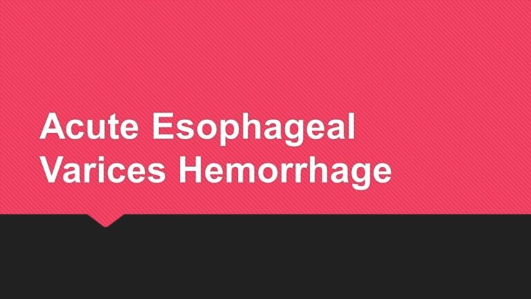 Read more about the article Acute Esophageal Varices Hemorrhage
