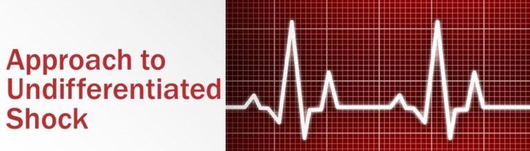 Read more about the article Approach to Undifferentiated Shock