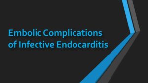 Read more about the article Embolic Complications of Infective Endocarditis