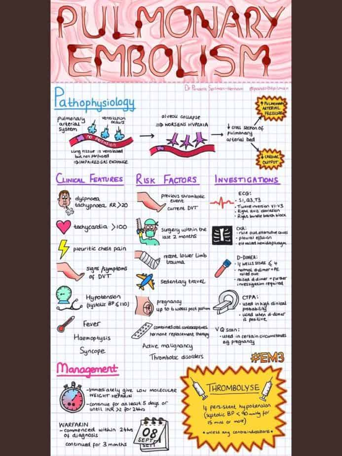 Read more about the article Pulmonary Thromboembolism and Thrombolytics