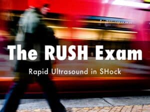 Read more about the article Rapid Ultrasound Exam in Shock (RUSH Exam)