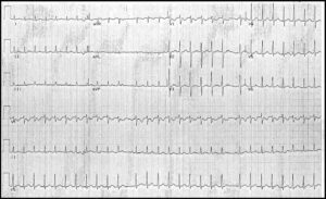 Read more about the article ECG Case 2