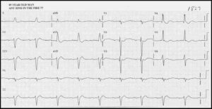 Read more about the article ECG Case 4