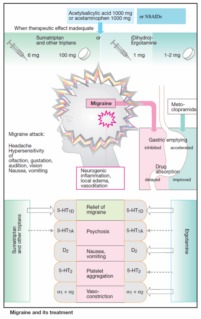 Migraine and its treatment