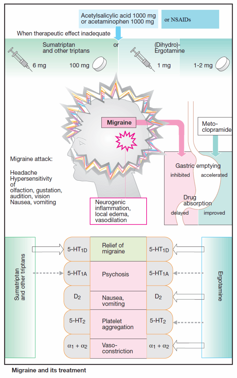 Headache Algorithm Manual of Medicine