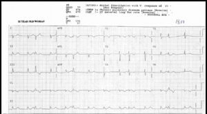 Read more about the article ECG Case 1