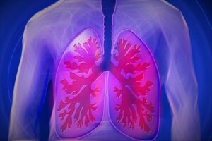 Read more about the article Acute Illnesses that Lead to Rapid Deterioration in Pulmonary Hypertension