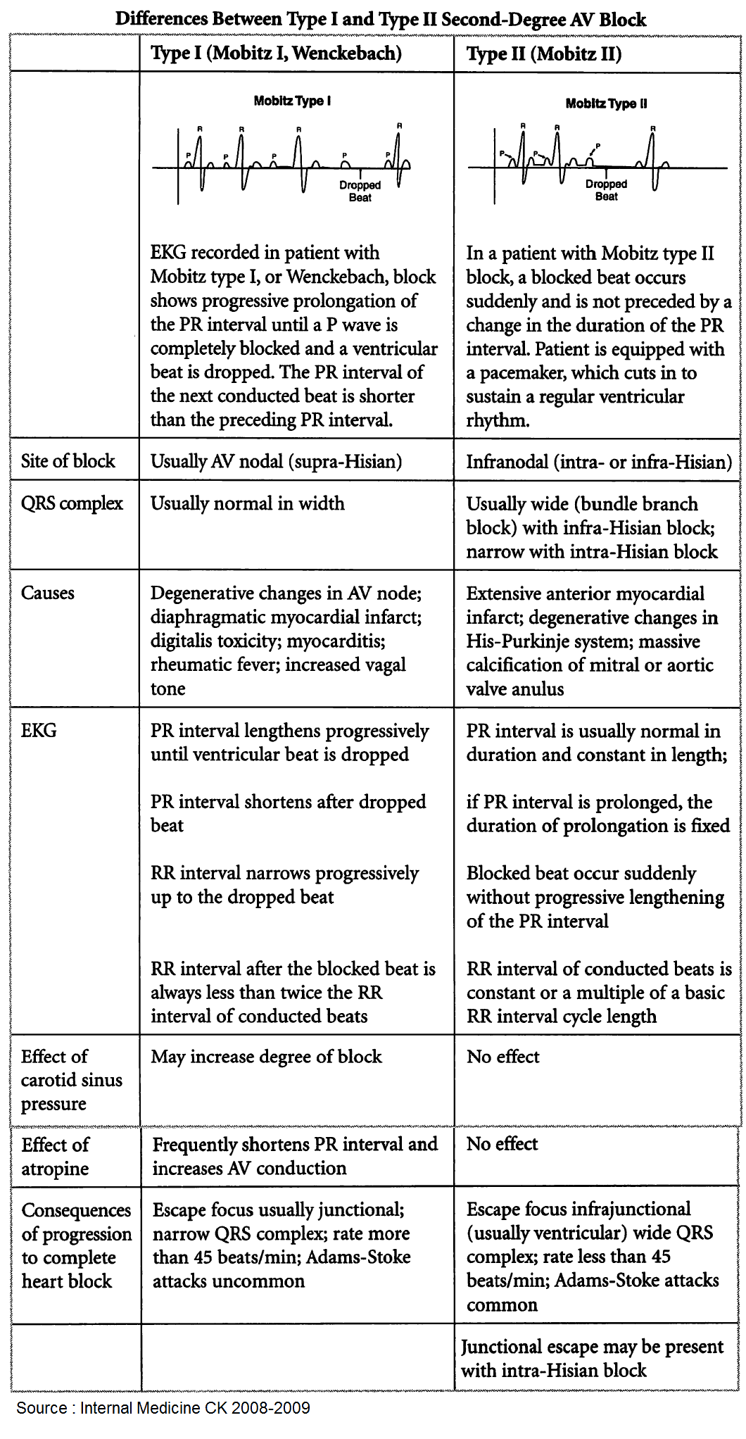 conduction-blocks-at-the-av-node-av-blocks-with-examples-manual