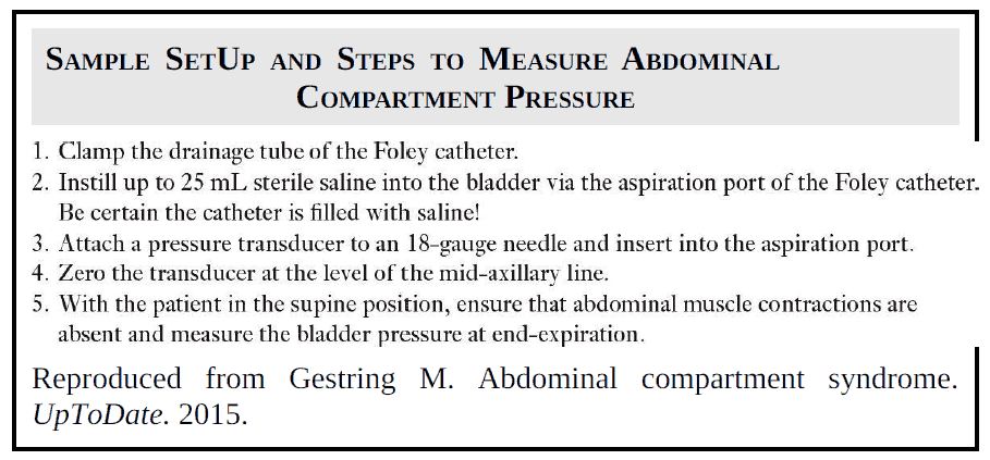 Sample Setup and Steps to Measure Abdominal Compartment Pressure