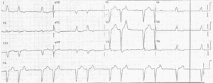 Read more about the article ECG Case 12