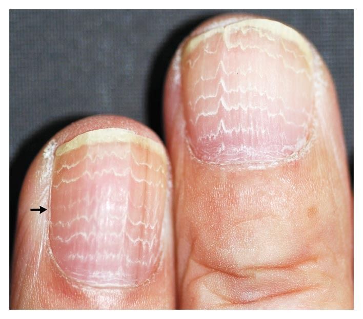 detail view of a manicurist's hands decorating a woman's nails with white  lines Stock Photo by mauriciotoro10