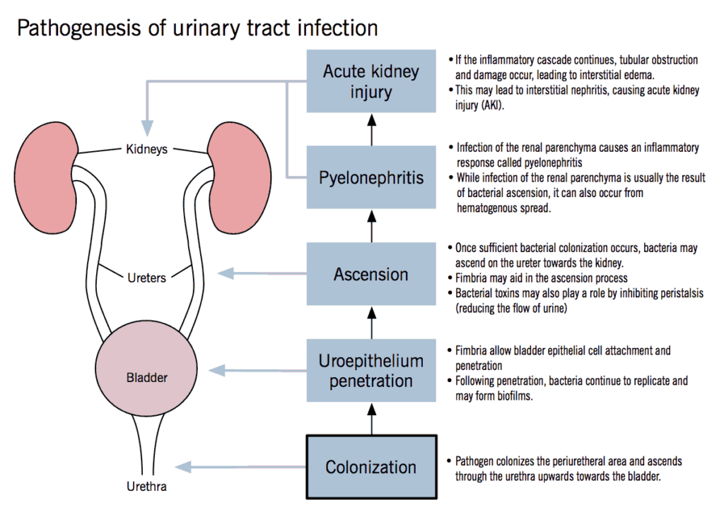 Pathogenesis of Urinary Tract Infection (UTI)