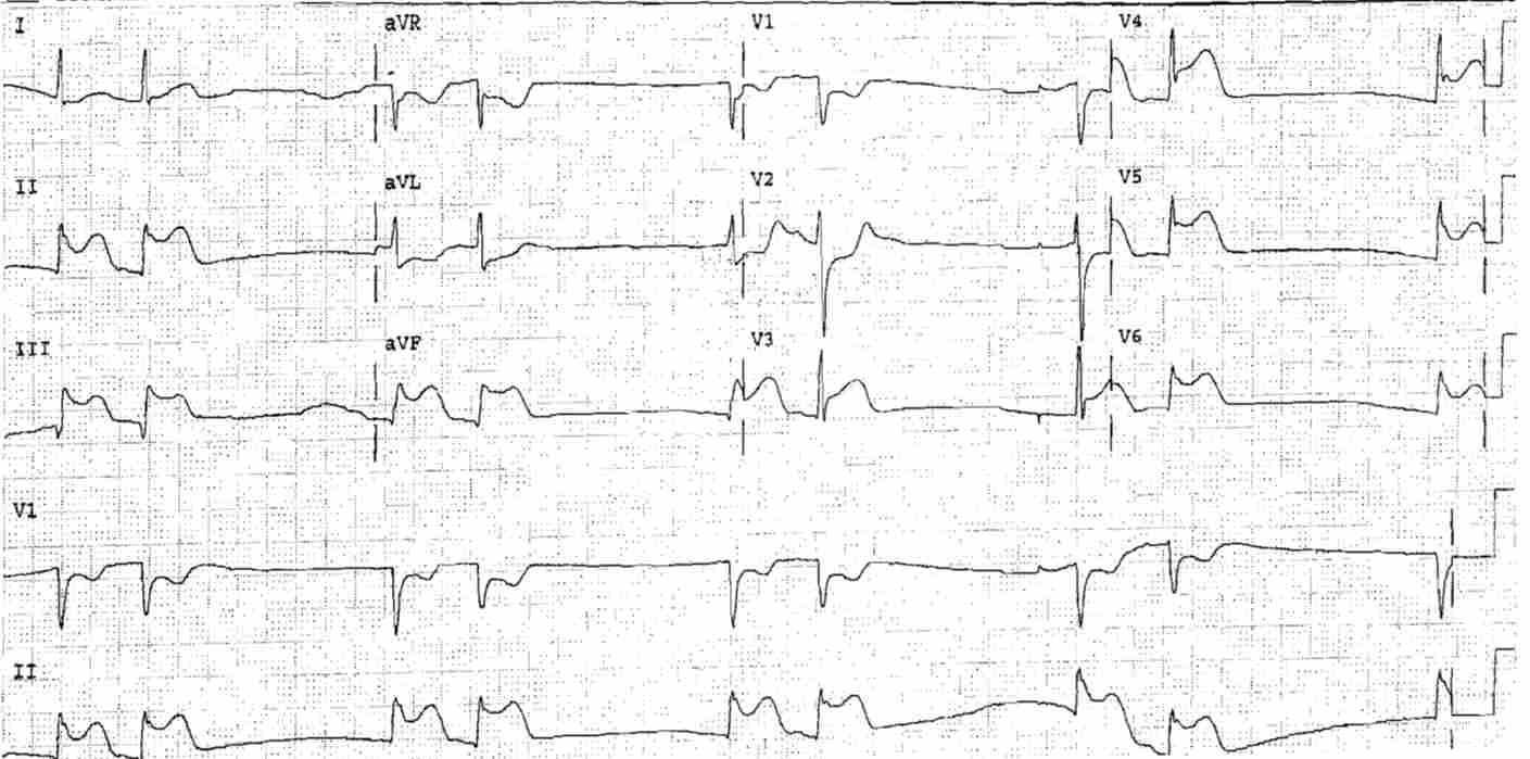 Read more about the article ECG Case 25