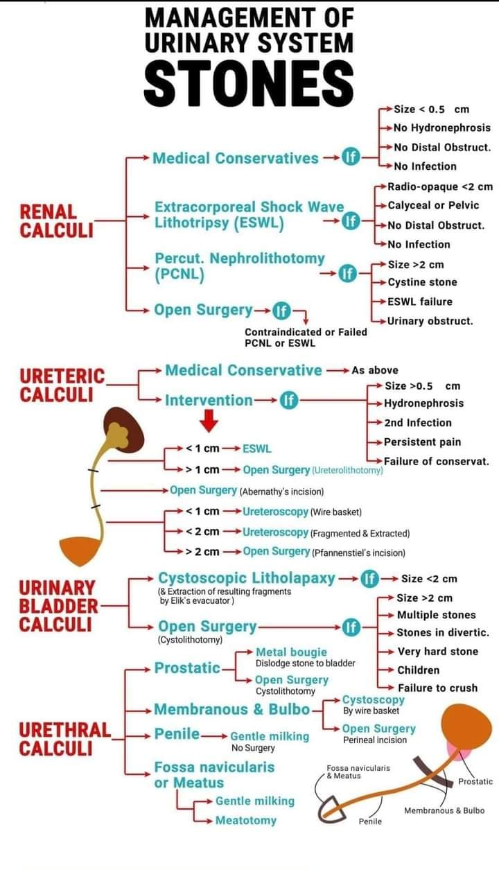 Management of Urinary System Stones