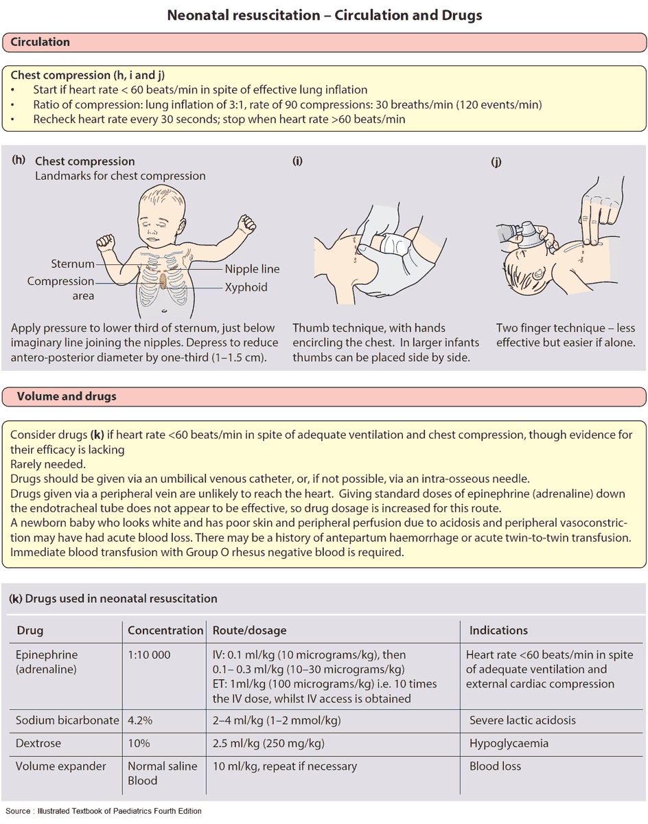 Crushing Neonate - Diagnostic Algorithm and Treatment - Manual of Medicine