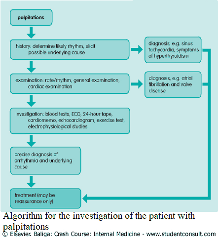 Algorithm for the investigation of the patient with palpitations