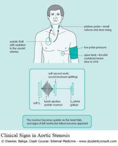 Heart Murmurs and Valvular Diseases - Differential Diagnosis ...