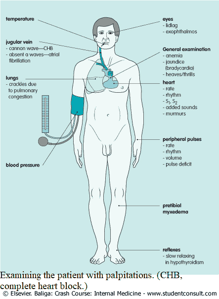 Examining the patient with palpitations