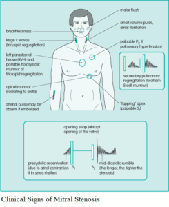 Read more about the article Heart Murmurs – Differential Diagnosis, Examination and Investigations