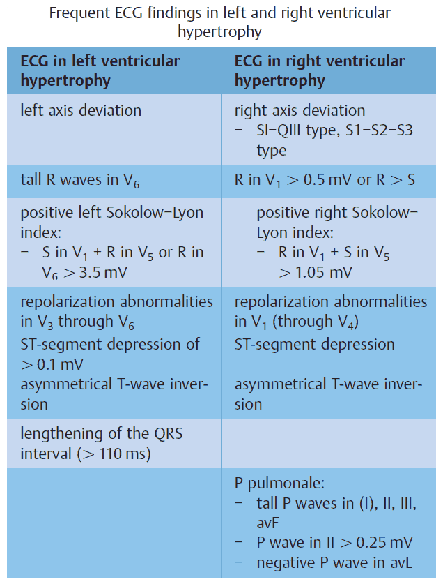 Frequent ECG findings in left and right ventricular hypertrophy