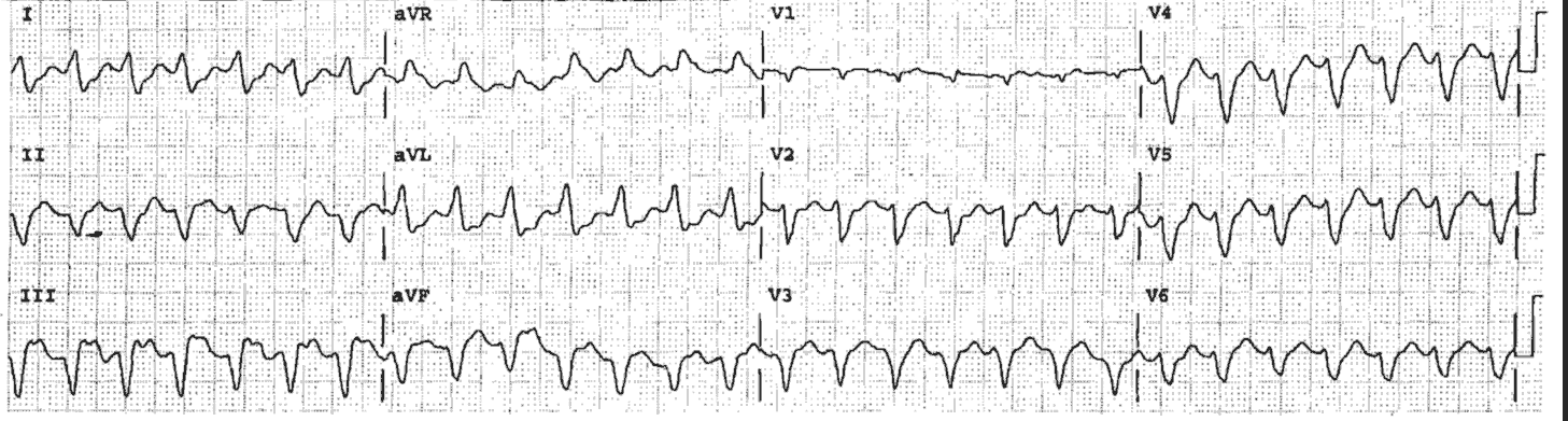 Read more about the article ECG Case 40