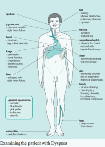 Shortness of Breath (Dyspnea): Differential Diagnosis, Examination and ...