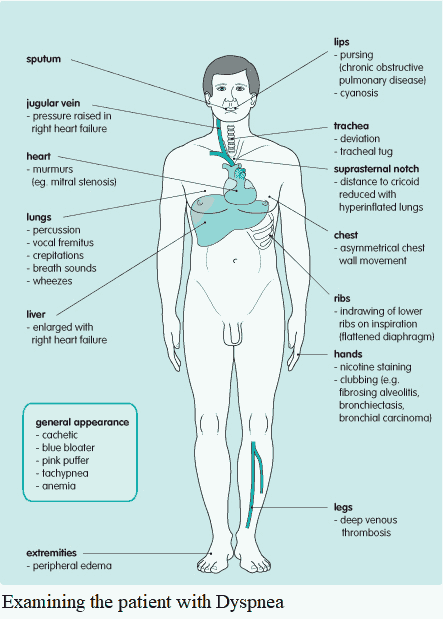 Examining the patient with Dyspnea