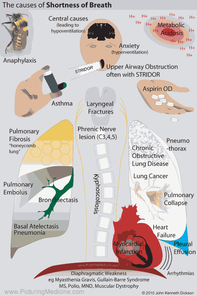 Trouble breathing symptoms, COVID-19: Long-term effects