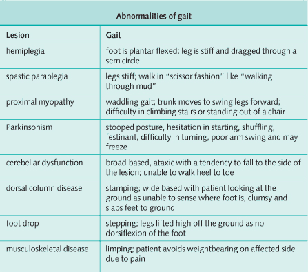 Abnormalities of gait