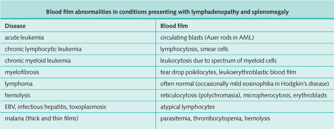 Blood film abnormalities in conditions presenting with lymphadenopathy and splenomegaly