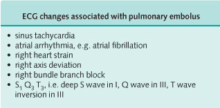 ECG changes associated with pulmonary embolus (Note that sinus tachycardia may be the only abnormality present)