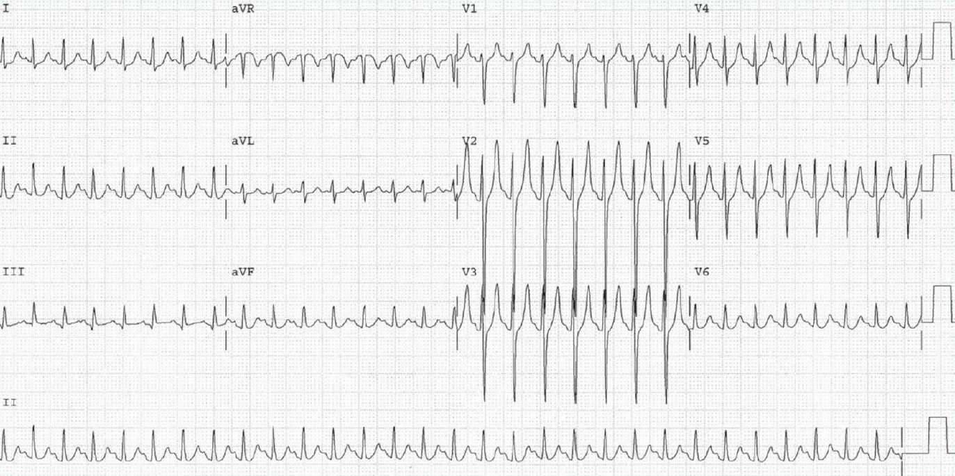 Read more about the article ECG Case 117