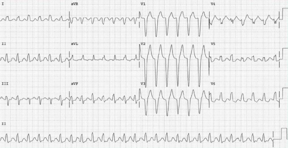 Read more about the article ECG Case 123