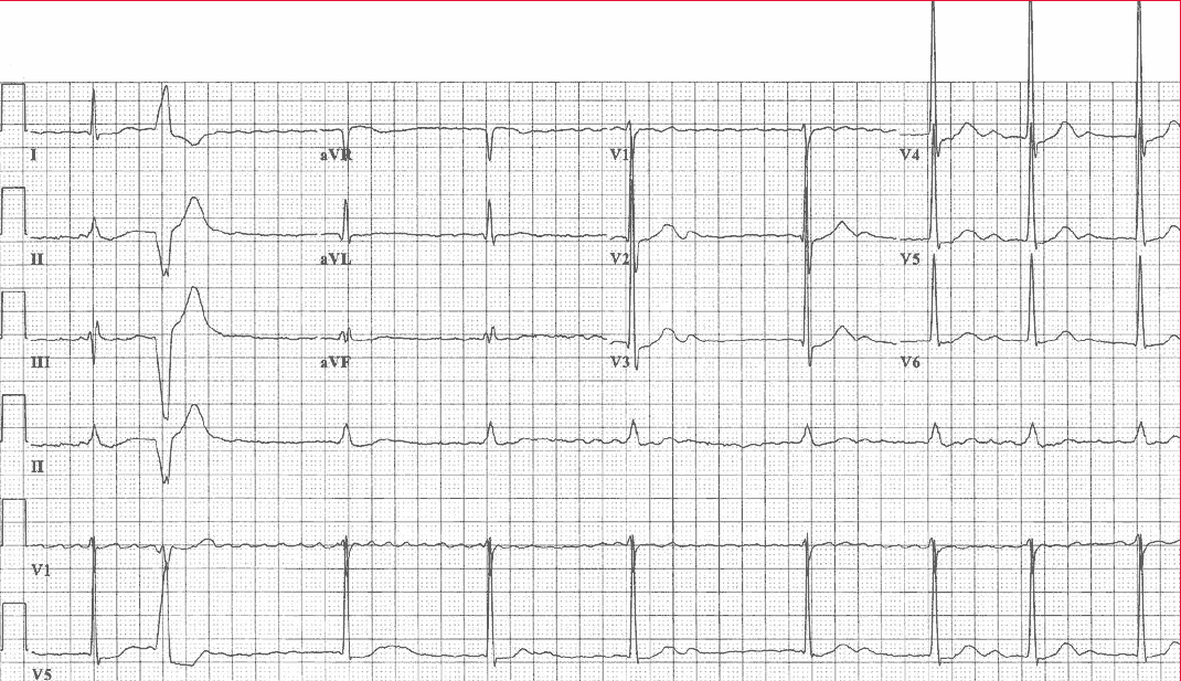 Read more about the article ECG Case 131
