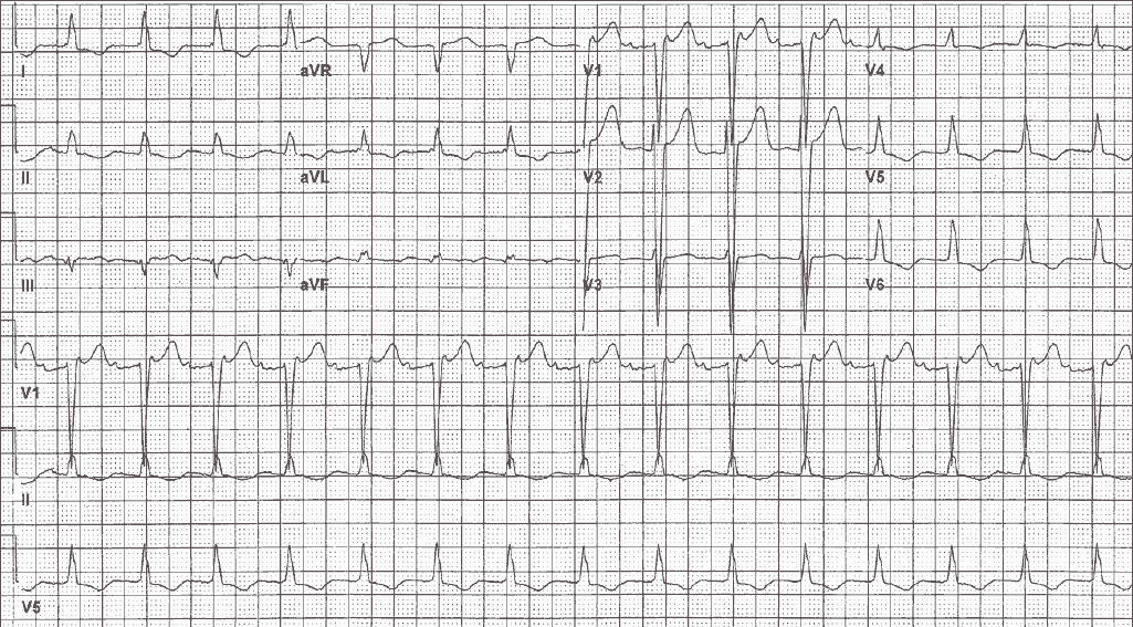 Read more about the article ECG Case 132