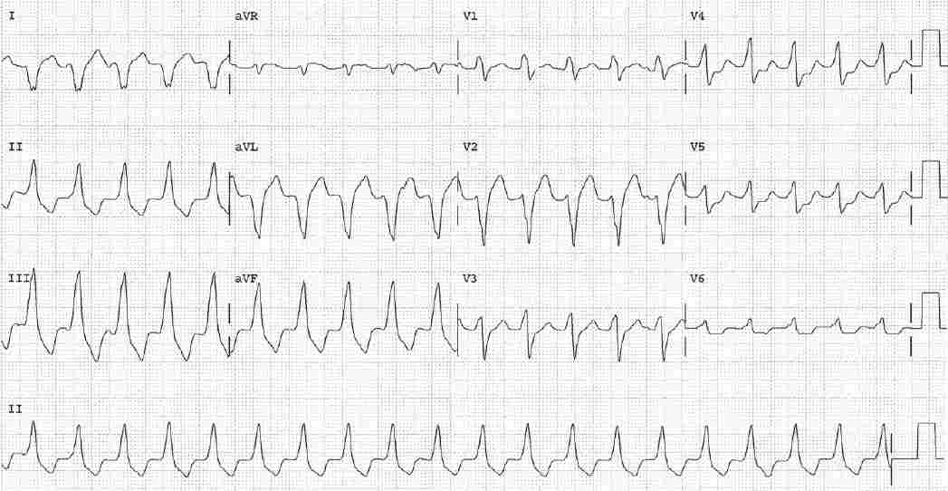Read more about the article ECG Case 133