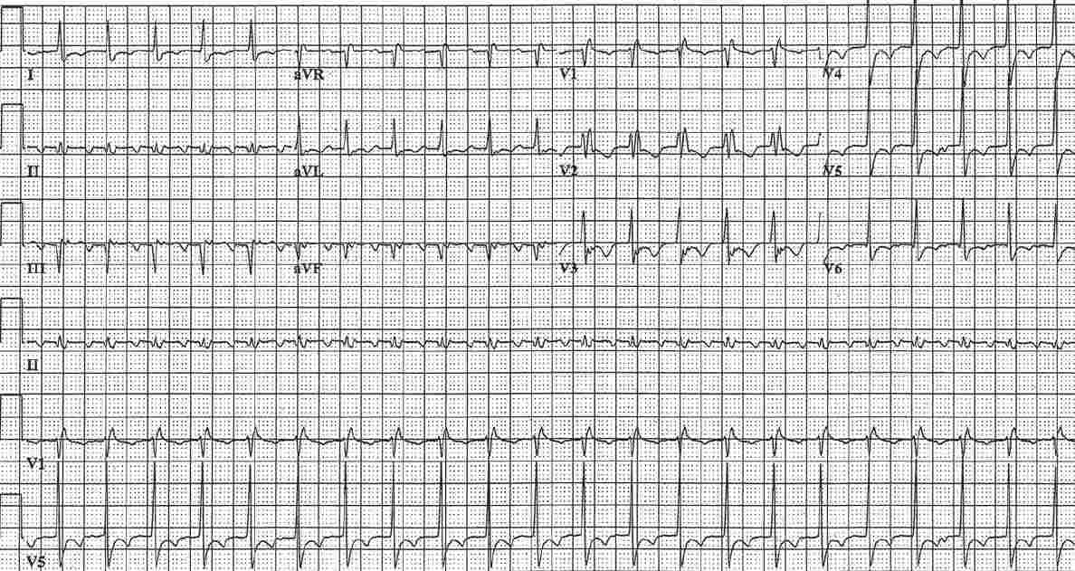 Read more about the article ECG Case 138