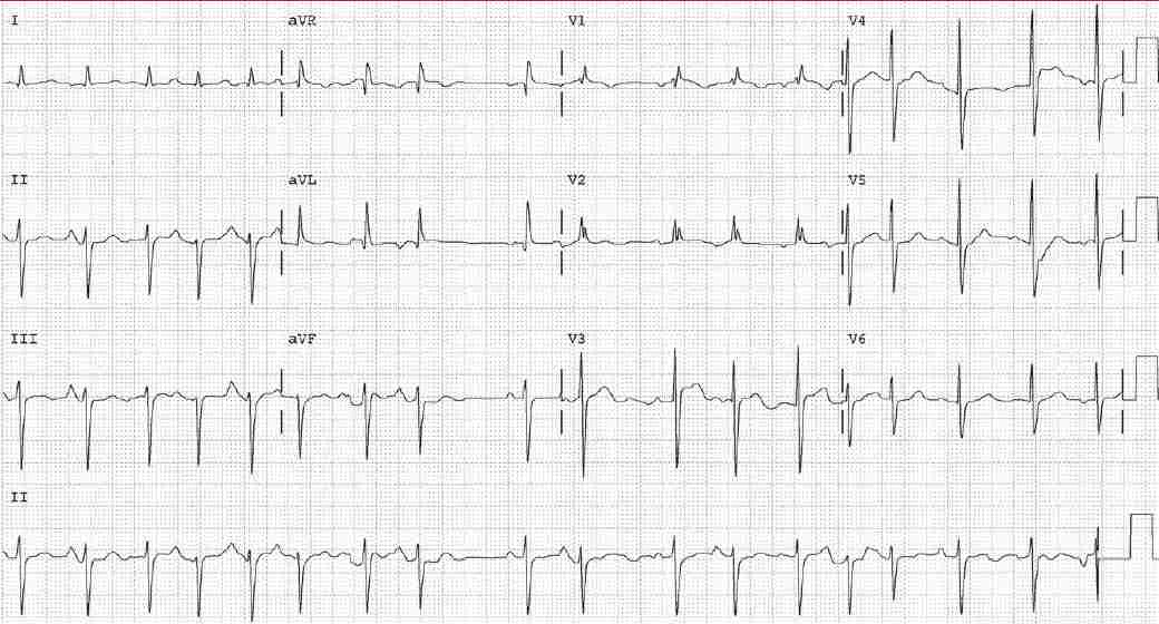 Read more about the article ECG Case 141