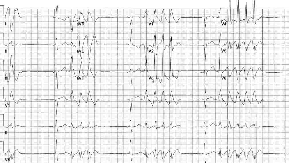 Read more about the article ECG Case 142