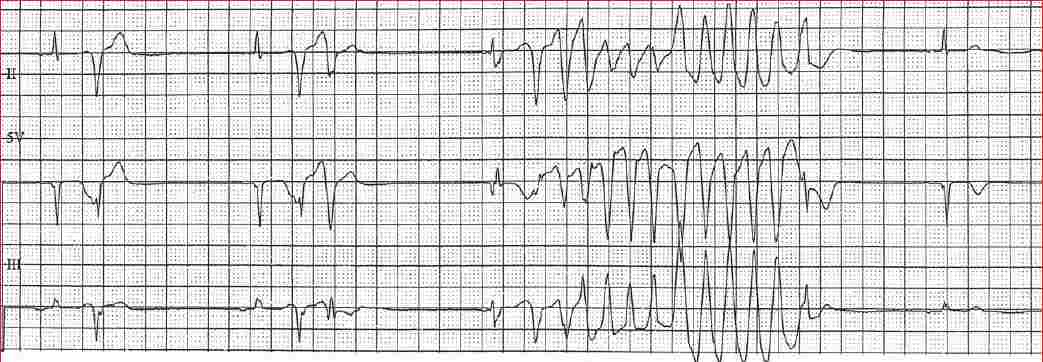 Read more about the article ECG Case 144