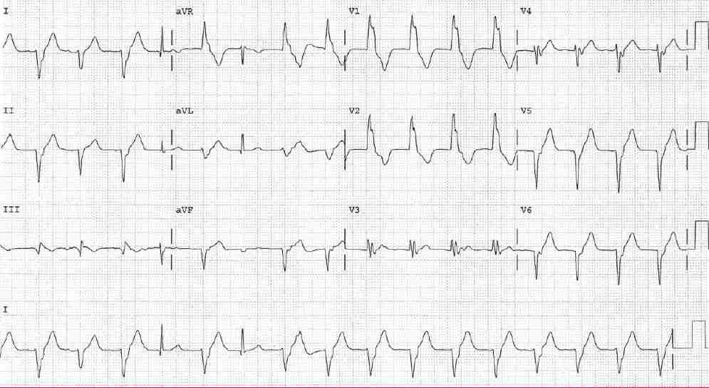 Read more about the article <strong>ECG Case 145</strong>