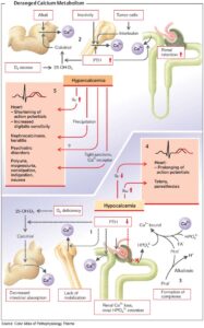 Read more about the article Disorders of Calcium Homeostasis (Hypocalcemia and Hypercalcemia)