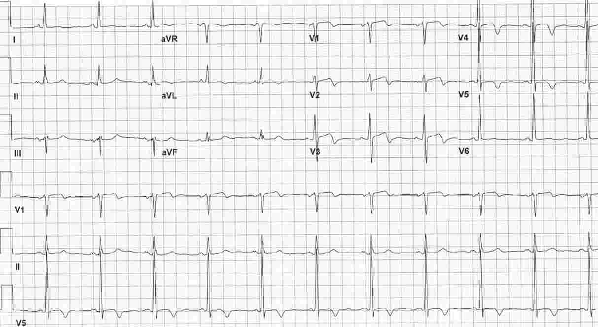 Read more about the article ECG Case 154