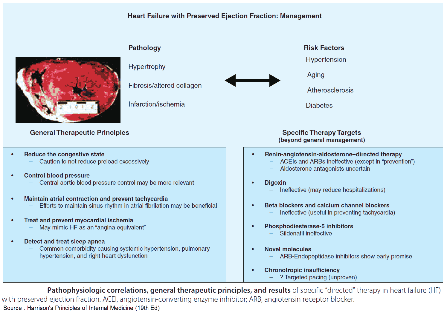 Management of Heart Failure with Preserved Ejection Fraction (HFpEF)