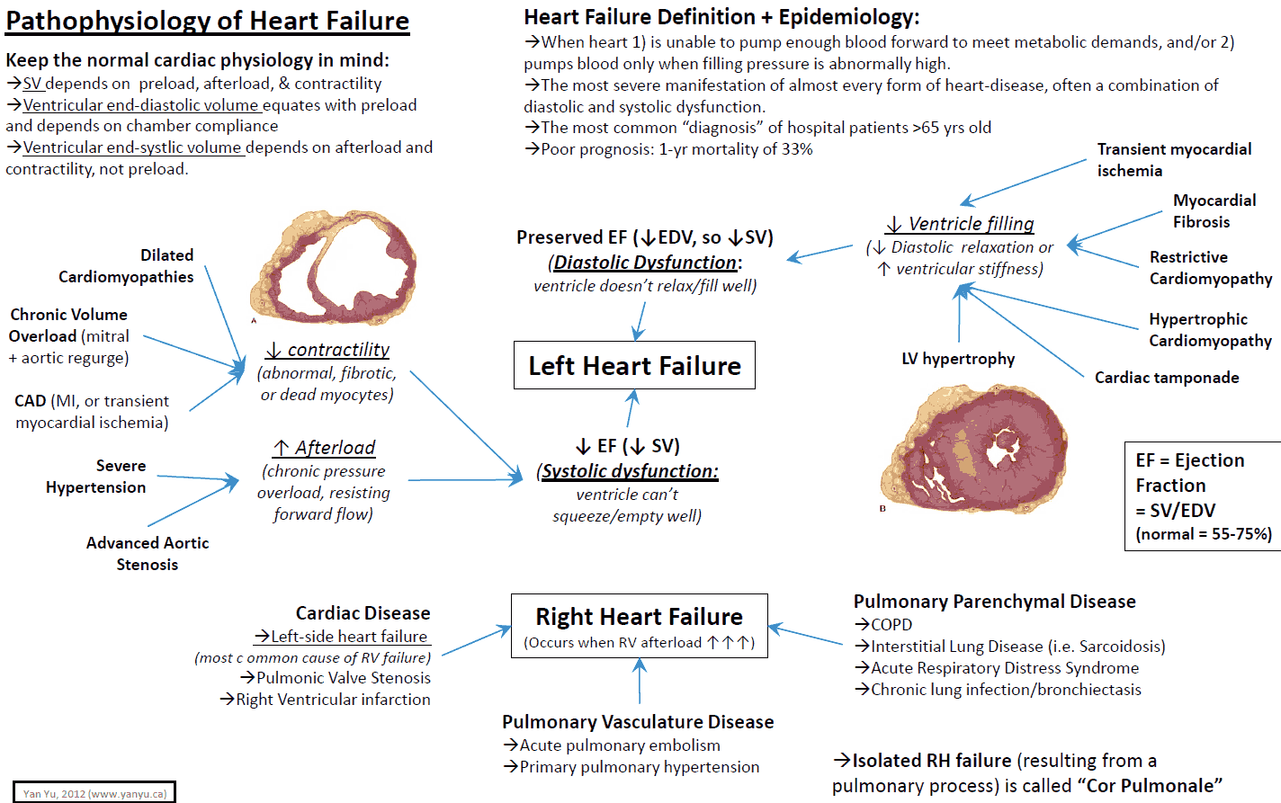 Evaluation and Management of Right-Sided Heart Failure: A