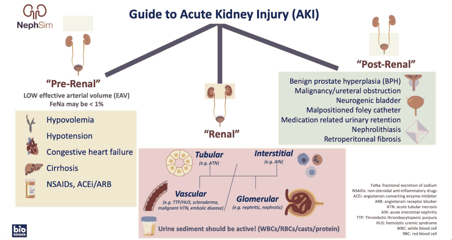 Acute Kidney Injury (AKI) - Causes