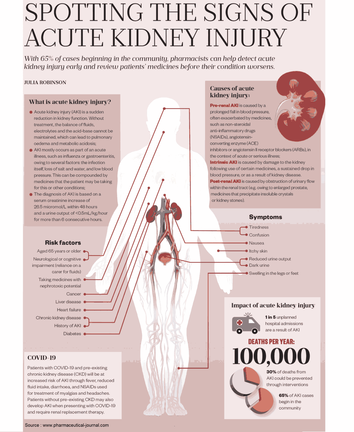 Acute Kidney Injury - Causes, Risk Factors and Symptoms