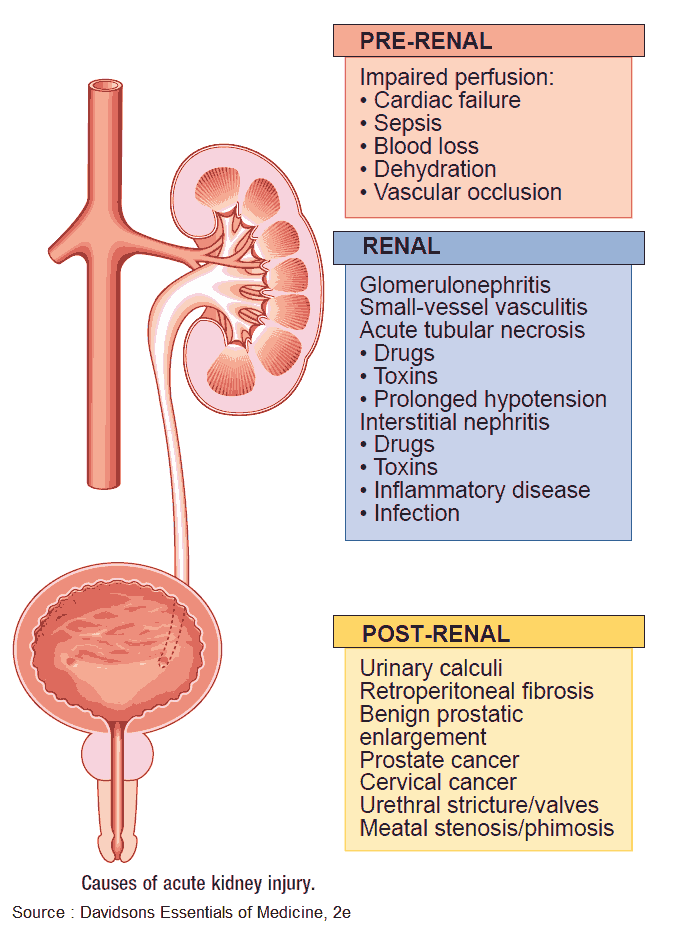 Causes of Acute Kidney Injury